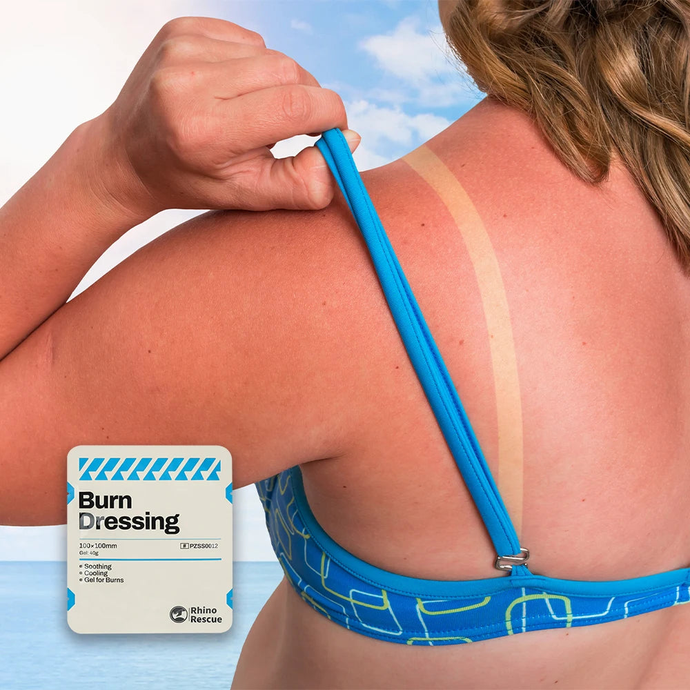 RHINO RESCUE Burn Care Kit: Burn Dressings, Burn Gel Packets, Cooling Cream